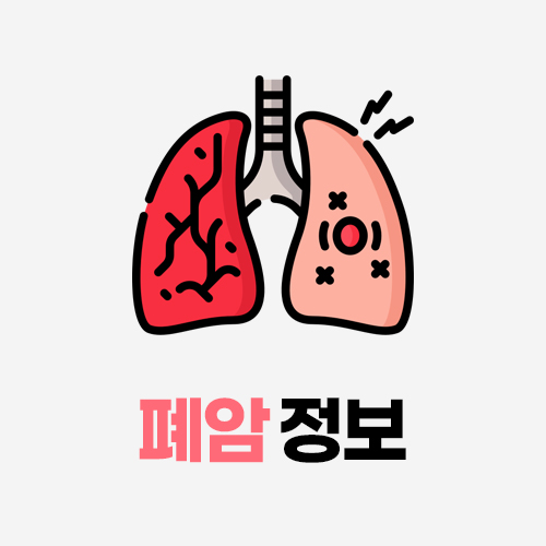 암오케이 폐암 정보